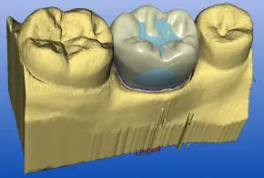cerec-melbourne software