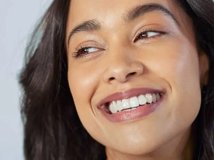 peg laterals treatment Essendon dental clinic Melbourne patient with beautiful smile peg laterals treatment Essendon dental clinic Melbourne patient with beautiful smile
