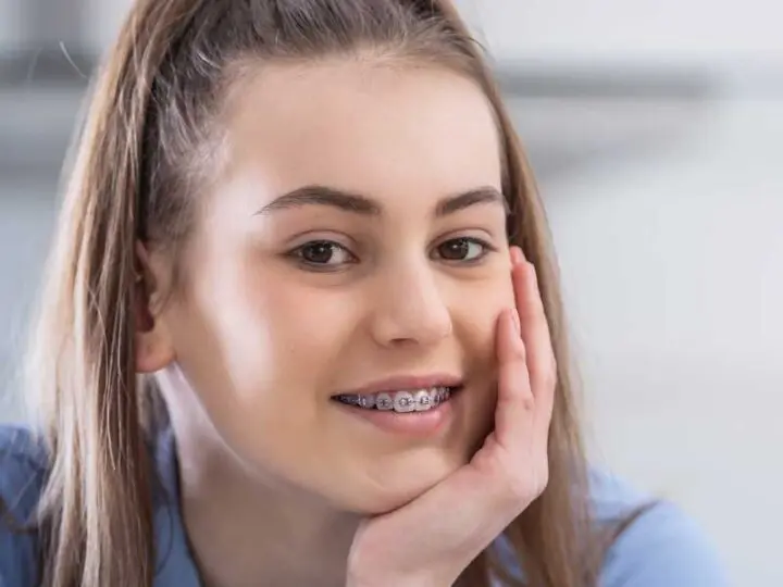 traditional metal braces worn by Melbourne smiling teen orthodontics Essendon clinic traditional metal braces worn by Melbourne smiling teen orthodontics Essendon clinic