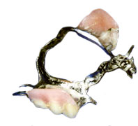 first bite dental cosmetic dentistry dentures dentures2