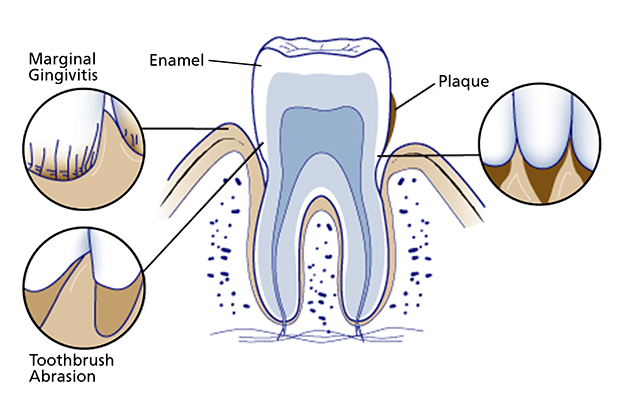 first-bite-dental-general-dentistry-sensitive-teeth-sensitive-v2