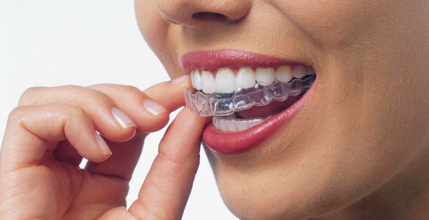 Braces Firstbite Dental Essendon Dentist Essendon Melbourne Orthodontics