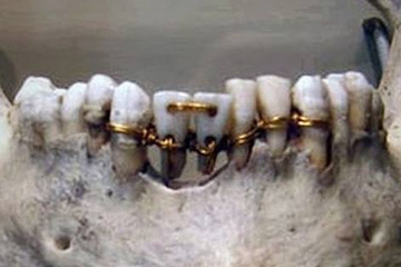 Ancient Egyptian Dentistry