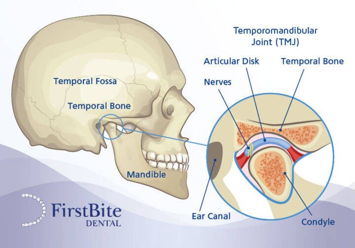 What is TMJ dysfunction TMD temporomandibular joint disorder jaw diagram Melbourne dentist Essendon What is TMJ dysfunction TMD temporomandibular joint disorder jaw diagram Melbourne dentist Essendon